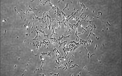 Human skeletal stem cells identified